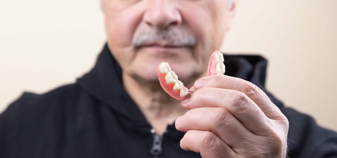 dental veneers