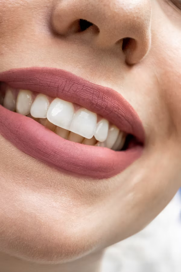 image of a woman's perfect teeth